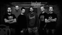 Concert Implant Pentru Refuz in Rockstadt