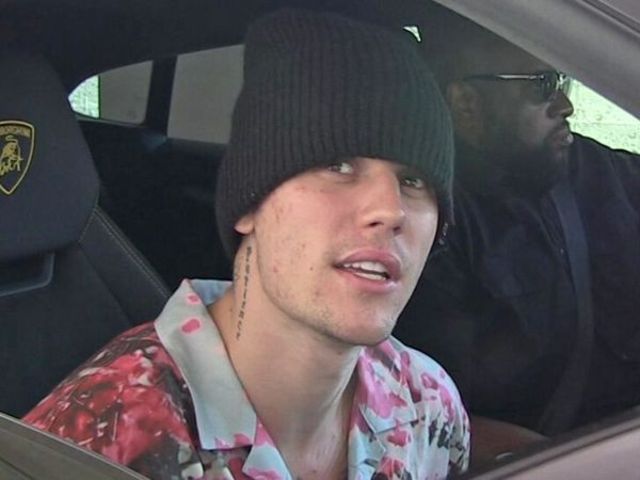 Justin Bieber diagnosticat cu boala Lyme