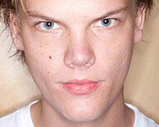 Tim Berg