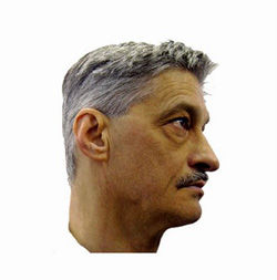 Calin Ioachimescu
